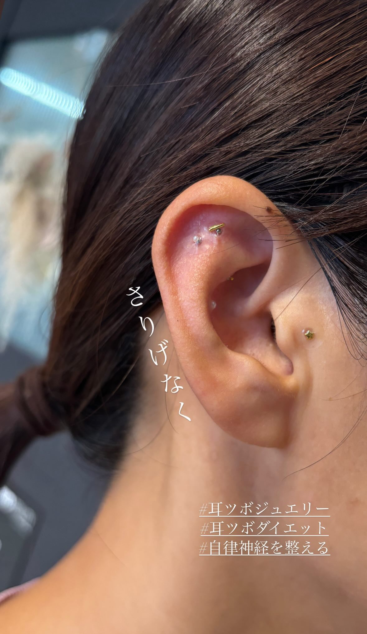 耳ツボジュエリー施術